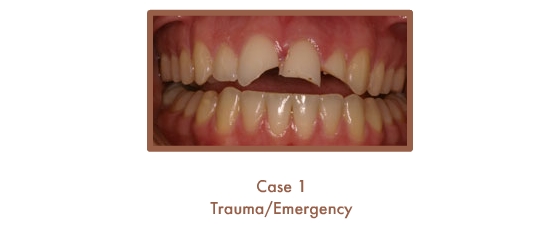 Trauma/Emergency