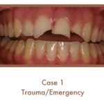 Trauma/Emergency