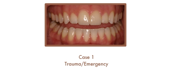 Trauma/Emergency