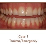 Trauma/Emergency