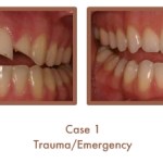 Trauma/Emergency