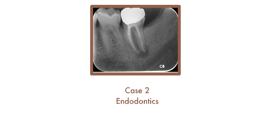 Case 2 Endodontics