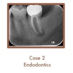 Case 2 Endodontics