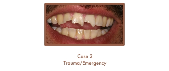 Trauma/Emergency