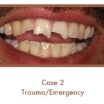 Trauma/Emergency