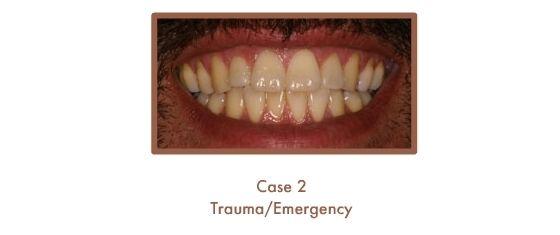 Trauma/Emergency