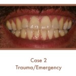 Trauma/Emergency