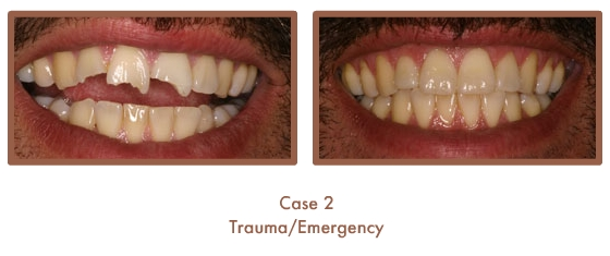 Trauma/Emergency
