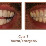 Trauma/Emergency