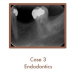 Case 3 Endodontics