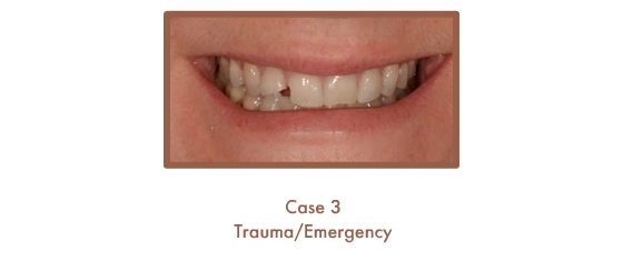 Trauma/Emergency