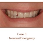 Trauma/Emergency