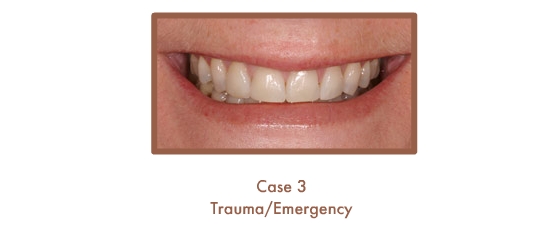 Trauma/Emergency