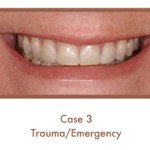 Trauma/Emergency
