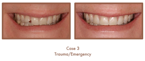 Trauma/Emergency