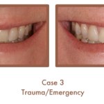 Trauma/Emergency